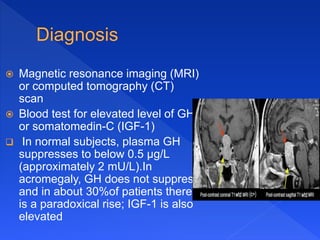  Magnetic resonance imaging (MRI)
or computed tomography (CT)
scan
 Blood test for elevated level of GH
or somatomedin-C (IGF-1)
 In normal subjects, plasma GH
suppresses to below 0.5 µg/L
(approximately 2 mU/L).In
acromegaly, GH does not suppress
and in about 30%of patients there
is a paradoxical rise; IGF-1 is also
elevated
 