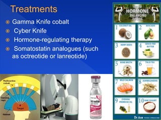  Gamma Knife cobalt
 Cyber Knife
 Hormone-regulating therapy
 Somatostatin analogues (such
as octreotide or lanreotide)
 