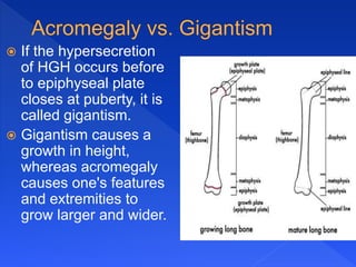  If the hypersecretion
of HGH occurs before
to epiphyseal plate
closes at puberty, it is
called gigantism.
 Gigantism causes a
growth in height,
whereas acromegaly
causes one's features
and extremities to
grow larger and wider.
 