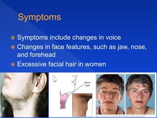  Symptoms include changes in voice
 Changes in face features, such as jaw, nose,
and forehead
 Excessive facial hair in women
 