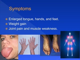  Enlarged tongue, hands, and feet.
 Weight gain
 Joint pain and muscle weakness.
 