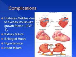  Diabetes Mellitus due
to excess insulin-like
growth factor-I (IGF-
1).
 Kidney failure
 Enlarged Heart
 Hypertension
 Heart failure
 