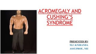 ACROMEGALY AND
CUSHING’S
SYNDROME
 