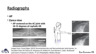 Acromioclavicular and Sternoclavicular Injuries.pptx