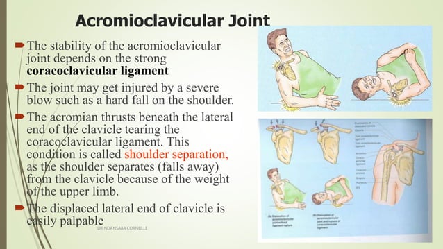 Acromioclavicular and sternoclavicular joint | PPTX | Death, Injury, or ...