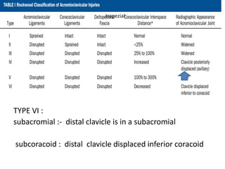 Acromioclavicular and sternoclaviculr injuries | PPTX