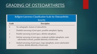 Acromioclavicular joint arthritis | PPTX