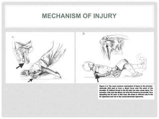 MECHANISM OF INJURY
 