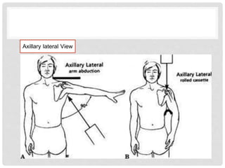 Axillary lateral View
 