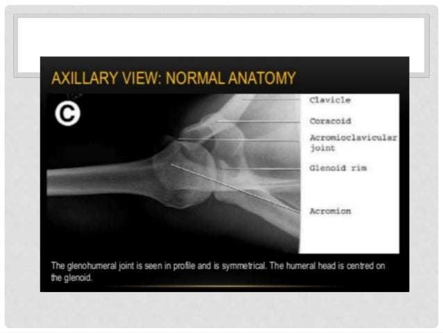 Pdf Acromioclavicular Joint And Clavicle Injuries