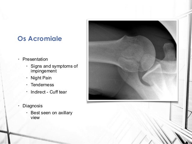 Acromion Os  acromiale  Fractures and Insufficiency