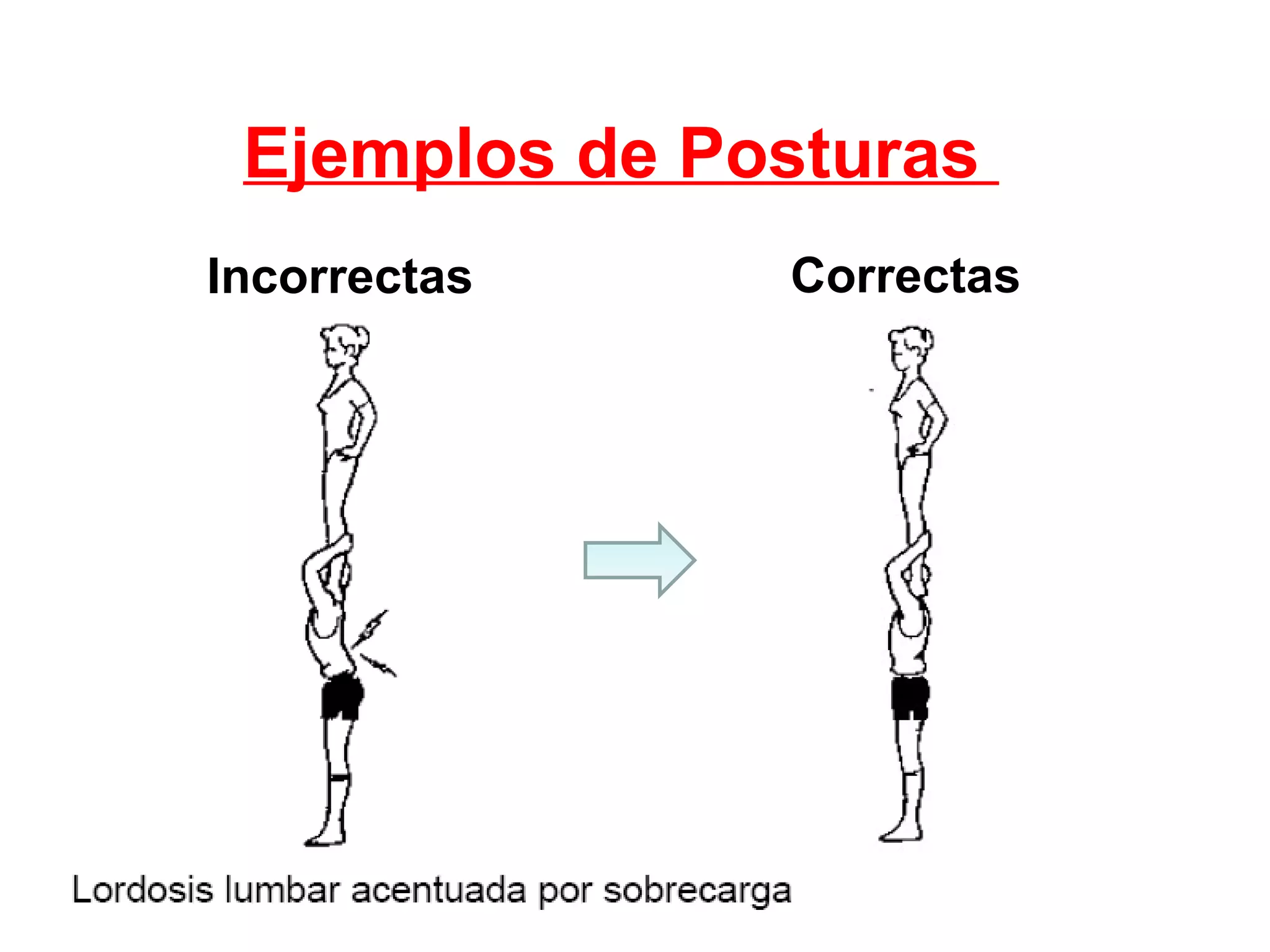 Ejemplos de Posturas  Incorrectas Correctas 