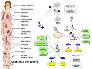 Cushing’s Syndrome
 
