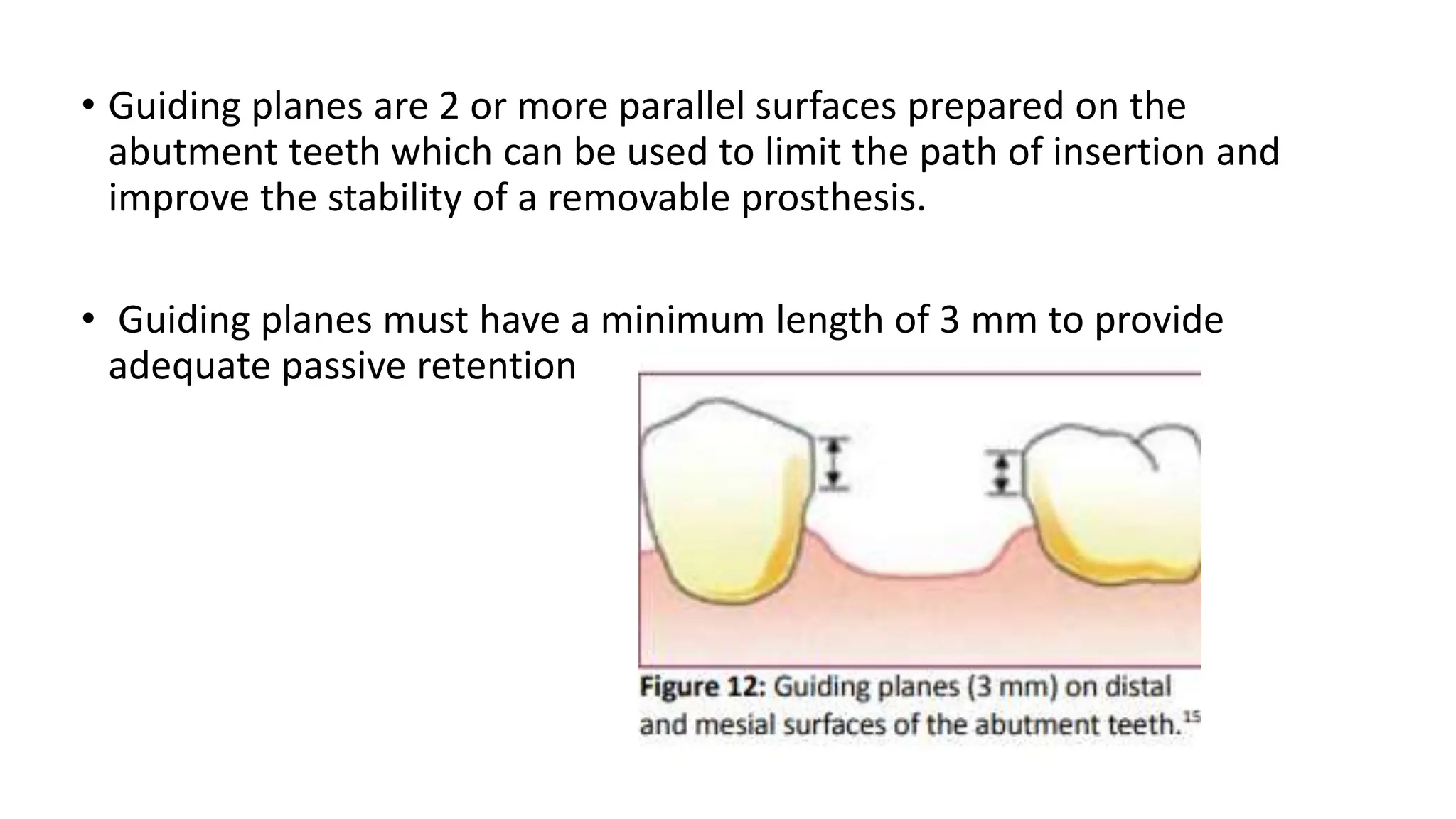 ACRYLIC PARTIAL DENTURES................ | PPTX