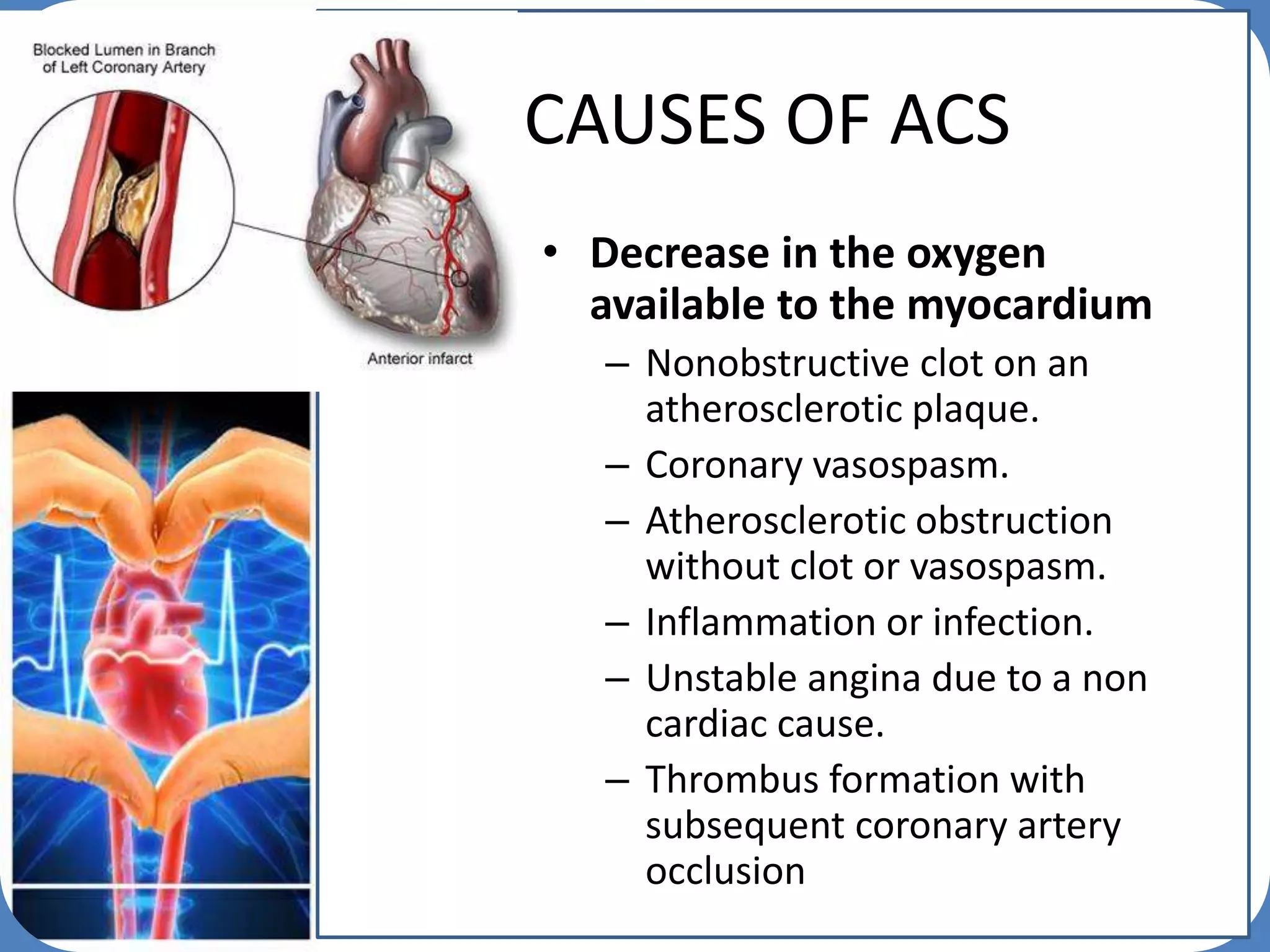 Acute coronary syndrome | PPTX