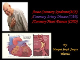 Acute Coronary Syndrome(ACS)
/Coronary Artery Disease (CAD)
/Coronary Heart Disease (CHD)
By:
Manjeet Singh Jangra
PharmD
 