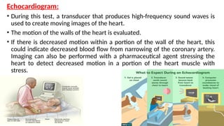 Coronary Heart Disease - Angina Pectoris tx | PPTX