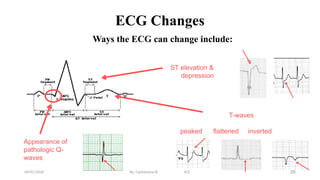 Comprehensive Overview of Acute Coronary Syndrome: Diagnosis ...