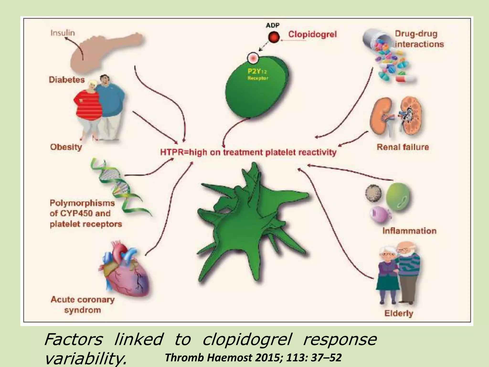 Factors linked to clopidogrel response
variability. Thromb Haemost 2015; 113: 37–52
 
