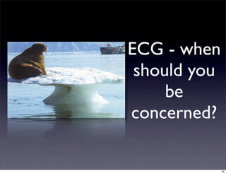 ECG - when
should you
be
concerned?
10
 