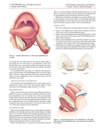 © 2004 WebMD, Inc. All rights reserved.                                                      ACS Surgery: Principles and Practice
2 HEAD AND NECK                                                                             5 ORAL CAVITY PROCEDURES — 3


                                                                          after 7 to 10 days. Patients with skin grafts should stay on a soft
                                                                          diet for 2 weeks. If a tracheotomy was performed, the patient may
                                                                          be decannulated when postoperative edema has settled.
                                                                             Meticulous and frequent oral hygiene is essential. Mouth rins-
                                                                          es and irrigation with normal saline or half-strength hydrogen
                                                                          peroxide should be done at least four times a day and after every
                                                                          meal. Teeth may be gently cleaned with a soft toothbrush.
                                                                          COMPLICATIONS

                                                                            The main complications of anterior glossectomy are as follows:
                                                                          1. Injury to the lingual nerve, which causes numbness and loss
                                                                             of the sense of taste in the ipsilateral tongue.
                                                                          2. Injury to the submandibular and sublingual gland ducts, which
                                                                             causes obstruction of the glands, pain and swelling, and pos-
                                                                             sibly ranula formation.
                                                                          3. Injury to the hypoglossal nerve, portions of which are resect-
                                                                             ed with the lesion. Injury to the main trunk of this nerve leads
                                                                             to paralysis and atrophy of the remaining ipsilateral tongue.
                                                                          4. Tethering and scarring of the tongue, which can lead to difﬁ-
                                                                             culties with speech and swallowing.This problem can usually be
                                                                             avoided by careful preoperative planning of reconstruction.



Figure 2 Anterior glossectomy. A stair-step mandibulotomy
is made.


neous ﬂaps from the radial forearm, the anterior lateral thigh, or
the lateral arm are well suited to reconstruction in this area.
Pedicled ﬂaps (e.g., myocutaneous ﬂaps from the pectoral mus-
cle) are also used in this setting, but they are bulkier and harder
to contour to the defects.
   If a mandibulotomy was made, it is repaired with the previ-
ously contoured plate. The lip-splitting incision is closed in three
layers (mucosa, muscle, and skin). Great care must be taken to
ensure accurate realignment of the vermilion border and the
orbicularis oris muscle.
   Alternative Procedure: Laser Vaporization
  Very superﬁcial and premalignant lesions of the tongue may be
vaporized by using a CO2 laser. The desired depth of tissue
destruction for leukoplakia is approximately 1 to 2 mm.
TROUBLESHOOTING

   Larger excisions may lead to airway edema.Whenever this pos-
sibility is a concern, a tracheostomy should be performed. A sin-
gle intraoperative dose of steroids may reduce postoperative
tongue edema without adversely affecting wound healing. Using
a stair-step incision for the lip-splitting incision facilitates accu-
rate reapproximation of the vermilion border. Excessive tongue
movement may result in dehiscence of the closure. Voice rest for
3 to 5 days after operation may be beneﬁcial.
POSTOPERATIVE CARE

   Patients who undergo primary closure of the tongue may begin a
ﬂuid diet on the day after operation; they should remain on a liquid
diet for 7 to 10 days. Patients who undergo skin grafting may also
begin a liquid diet on postoperative day 1. If a ﬂap was used to close
the defect or if there is some question whether the patient will be ca-
pable of adequate oral intake, a nasogastric feeding tube should be       Figure 3 Anterior glossectomy. As an alternative to a lip-split-
inserted and maintained until the suture lines heal.                      ting incision with mandibulotomy, a visor ﬂap may be employed
   Bolster dressings may be removed and skin grafts inspected             for exposure.
 
