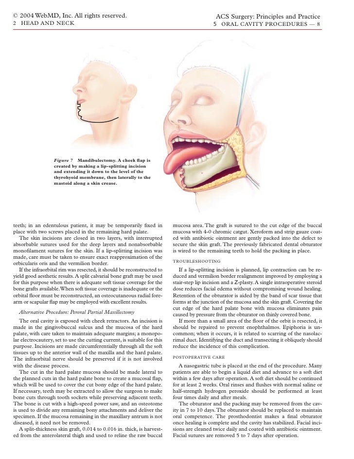 Acs0205 Oral Cavity Procedures