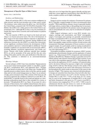 Acs0304 Surgical Management Of Melanoma And Other Skin Cancers | PDF
