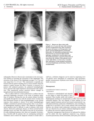© 2005 WebMD, Inc. All rights reserved.                                                   ACS Surgery: Principles and Practice
4 THORAX                                                                                     6 PARALYZED DIAPHRAGM — 4

                 a                                                    b




                 c
                                                                      Figure 3 Shown are three chest radi-
                                                                      ographs of a 25-year-old man with residual
                                                                      anterior mediastinal mass after treatment
                                                                      for germ cell tumor. (a) Preoperative view
                                                                      shows normal diaphragmatic positioning
                                                                      bilaterally. (b) Immediate postoperative view
                                                                      demonstrates an elevated right hemidi-
                                                                      aphragm, attributed to stretch injury and
                                                                      electrothermal injury caused by dissection of
                                                                      mass from the vicinity of the phrenic nerve
                                                                      at the right hilum. (c) Late view, 3 months
                                                                      after operation, reveals gradual restoration
                                                                      of normal diaphragm positioning. Patient is
                                                                      asymptomatic.




radiographs. However, ﬂuoroscopic examination is the most prac-       sniff test, a deﬁnitive diagnosis can be made by employing cervi-
tical method of assessing the movement of the diaphragm. The          cal phrenic nerve stimulation in conjunction with electromyo-
excursion of the domes of the diaphragm averages 3 to 5 cm and        graphic measurement of phrenic nerve latency.13 This ﬁnal test is
may range from 2 to 10 cm.11 The examination is typically per-        rarely necessary.
formed with the patient standing, but it is more sensitive when the
patient is supine because the effect of gravity is removed. In a
patient with unilateral paralysis, the paralyzed hemidiaphragm        Management
moves upward with rapid inspiration and downward with expira-
                                                                      CONSERVATIVE VERSUS SURGICAL
tion. This paradoxical motion passively follows changes in
                                                                      TREATMENT
intrapleural and intra-abdominal pressure.
   The so-called sniff test is then performed to conﬁrm that the         Treatment is individualized and depends
abnormal diaphragm excursion is the result of paralysis rather        on the degree to which the patient is inca-
than of weakness. During this test, the patient inhales forcefully    pacitated. Most healthy adults with isolated
and rapidly through the nose with the mouth closed. A sharp and       diaphragmatic paralysis are asymptomatic or suffer only from mild
brief downward motion in both hemidiaphragms is the normal            exertional dyspnea. The vast majority of these patients do not
response when paralysis is absent. If an entire hemidiaphragm         require surgical treatment and are best treated conservatively (e.g.,
exhibits a paradoxical upward motion greater than 2 cm, howev-        with physical therapy, pulmonary rehabilitation, and counseling on
er, diaphragmatic paralysis is likely.12 The diagnosis of diaphrag-   weight loss, if necessary). Just as many patients with normal lung
matic paralysis may be difﬁcult to make in patients with severe       function can tolerate major pulmonary resections, most patients
chronic obstructive pulmonary disease, in whom normal hemidi-         who are otherwise ﬁt can tolerate unilateral diaphragmatic paraly-
aphragms move very little. The sniff test may also be inconclusive    sis without the need for surgical intervention.
in weak, debilitated patients, who often are incapable of produc-        Operative management may, however, be indicated for children
ing a forceful sniff. In patients who are undergoing mechanical       and for adults who have signiﬁcant symptoms (e.g., dyspnea,
ventilation and in whom the diagnosis remains in doubt after a        recurrent pneumonia, chronic bronchitis, chest pain, poor exercise
 