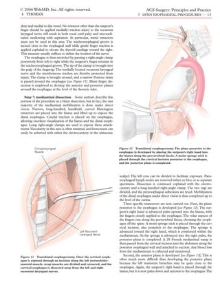 © 2006 WebMD, Inc. All rights reserved.                                                    ACS Surgery: Principles and Practice
4 THORAX                                                                             7 OPEN ESOPHAGEAL PROCEDURES — 13


deep and medial to this vessel. No retractor other than the surgeon’s
ﬁnger should be applied medially: traction injury to the recurrent
laryngeal nerve will result in both vocal cord palsy and uncoordi-
nated swallowing with aspiration. In particular, metal retractors
must not be used in this area. The tracheoesophageal groove is
incised close to the esophageal wall while gentle ﬁnger traction is
applied cephalad to elevate the thyroid cartilage toward the right.
This measure usually sufﬁces to deﬁne the location of the nerve.
   The esophagus is then encircled by passing a right-angle clamp
posteriorly from left to right while the surgeon’s ﬁnger remains in
the tracheoesophageal groove.The tip of the clamp is brought into
the pulp of the ﬁngertip.The medially located recurrent laryngeal
nerve and the membranous trachea are thereby protected from
injury.The clamp is brought around, and a narrow Penrose drain
is passed around the esophagus [see Figure 11]. Blunt ﬁnger dis-
section is employed to develop the anterior and posterior planes
around the esophagus at the level of the thoracic inlet.

   Step 7: mediastinal dissection Some authors describe this
portion of the procedure as a blunt dissection, but in fact, the vast
majority of the mediastinal mobilization is done under direct
vision. Narrow, long-handled, handheld, curved Harrington
retractors are placed into the hiatus and lifted up to expose the
distal esophagus. Caudal traction is placed on the esophagus,
allowing excellent visualization of the hiatus and the distal esoph-
agus. Long right-angle clamps are used to expose these attach-
ments.Vascularity in this area is often minimal, and hemostasis can
easily be achieved with either the electrocautery or the ultrasonic



          Cricopharyngeal                                               Figure 12 Transhiatal esophagectomy. The plane posterior to the
          Muscle                                                        esophagus is developed by placing the surgeon’s right hand into
                                                                        the hiatus along the prevertebral fascia. A moist sponge stick is
                                                                        placed through the cervical incision posterior to the esophagus,
                                                                        and the posterior plane is completed.



                                                                        scalpel. The left crus can be divided to facilitate exposure. Para-
                                                                        esophageal lymph nodes are removed either en bloc or as separate
                                                                        specimens. Dissection is continued cephalad with the electro-
                                                                        cautery and a long-handled right-angle clamp. The two vagi are
                                                                        divided, and the periesophageal adhesions are lysed. Mobilization
                                                                        of the distal esophagus under direct vision is thus completed up to
                                                                        the level of the carina.
                                                                           Three speciﬁc maneuvers are now carried out. First, the plane
                                                                        posterior to the esophagus is developed [see Figure 12]. The sur-
                                                                        geon’s right hand is advanced palm upward into the hiatus, with
                                                                        the ﬁngers closely applied to the esophagus. The volar aspects of
                                                                        the ﬁngers run along the prevertebral fascia, elevating the esoph-
                                                                        agus off the spine. A moist sponge stick is placed through the cer-
                                                                        vical incision, also posterior to the esophagus. The sponge is
                                            Left Recurrent              advanced toward the right hand, which is positioned within the
                                            Laryngeal Nerve             mediastinum. As the sponge is advanced into the right palm, the
                                                                        posterior plane is completed. A 28 French mediastinal sump is
                                                                        then passed from the cervical incision into the abdomen along the
                                                                        posterior esophageal wall and attached to suction. Any blood loss
                                                                        from the mediastinum is collected and monitored.
Figure 11 Transhiatal esophagectomy. Once the cervical esoph-
                                                                           Second, the anterior plane is developed [see Figure 13]. This is
agus is exposed through an incision along the left sternocleido-        often much more difﬁcult than developing the posterior plane
mastoid muscle, strap muscles are divided and retracted, and the        because the left mainstem bronchus may be quite close to the
cervical esophagus is dissected away from the left and right            esophagus. Again, the surgeon’s right hand is placed through the
recurrent laryngeal nerves.                                             hiatus, but it is now palm down and anterior to the esophagus.The
 