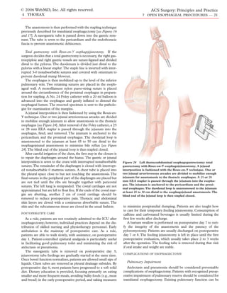 © 2006 WebMD, Inc. All rights reserved.                                                         ACS Surgery: Principles and Practice
4 THORAX                                                                                 7 OPEN ESOPHAGEAL PROCEDURES — 21


   The anastomosis is then performed with the stapling technique
previously described for transhiatal esophagectomy [see Figures 16
and 17]. A nasogastric tube is passed down into the gastric rem-
nant. The tube is sewn to the pericardium and the endothoracic
fascia to prevent anastomotic dehiscence.

   Total gastrectomy with Roux-en-Y esophagojejunostomy. If the
surgeon decides that a total gastrectomy is necessary, the right gas-
troepiploic and right gastric vessels are suture-ligated and divided
distal to the pylorus. The duodenum is divided just distal to the
pylorus with a linear stapler.The staple line is inverted with inter-
rupted 3-0 nonabsorbable sutures and covered with omentum to
prevent duodenal stump blowout.
   The esophagus is then mobilized up to the level of the inferior
pulmonary vein. Two retaining sutures are placed in the esoph-
ageal wall. A monoﬁlament nylon purse-string suture is placed
around the circumference of the proximal esophagus in prepara-
tion for stapling. A No. 24 Foley catheter with a 20 ml balloon is
advanced into the esophagus and gently inﬂated to distend the
esophageal lumen. The resected specimen is sent to the patholo-
gist for examination of the margins.
   A jejunal interposition is then fashioned by using the Roux-en-
Y technique. One or two jejunal arteriovenous arcades are divided
to mobilize enough jejunum to allow anastomosis to the thoracic
esophagus [see Figure 24]. After removal of the Foley catheter, a 25
or 28 mm EEA stapler is passed through the jejunum into the
esophagus, ﬁred, and removed. The jejunum is anchored to the
pericardium and the proximal esophagus. The duodenal loop is
anastomosed to the jejunum at least 45 to 50 cm distal to the
esophagojejunal anastomosis to minimize bile reﬂux [see Figure
24].The blind end of the jejunal loop is then stapled closed.
   After careful irrigation of the chest, the ﬁrst step in the closure is
to repair the diaphragm around the hiatus. The gastric or jejunal
interposition is sewn to the crura with interrupted nonabsorbable           Figure 24 Left thoracoabdominal esophagogastrectomy: total
sutures. The remainder of the diaphragm is closed with interrupt-           gastrectomy with Roux-en-Y esophagojejunostomy. A jejunal
ed nonabsorbable 0 mattress sutures. A chest tube is placed into            interposition is fashioned with the Roux-en-Y technique. One or
the pleural space close to but not touching the anastomosis. The            two jejunal arteriovenous arcades are divided to mobilize enough
ﬁnal sutures in the peripheral part of the diaphragm are placed but         jejunum for anastomosis to the thoracic esophagus. A 25 or 28
are not tied until the ribs are brought together with pericostal            mm EEA stapler is passed through the jejunum into the esopha-
                                                                            gus. The jejunum is anchored to the pericardium and the proxi-
sutures. The left lung is reexpanded. The costal cartilages are not
                                                                            mal esophagus. The duodenal loop is anastomosed to the jejunum
approximated but are left to ﬂoat free. If the ends of the costal mar-      at least 45 to 50 cm distal to the esophagojejunal anastomosis. The
gin are abutting, another 2 cm of costal cartilage should be                blind end of the jejunal loop is then stapled closed.
removed to reduce postoperative pain. Thoracic and abdominal
skin layers are closed with a continuous absorbable suture. The
skin and the subcutaneous tissue are closed in the usual fashion.           to minimize postprandial dumping. Patients are also taught how
                                                                            to care for their temporary feeding jejunostomy. Consumption of
POSTOPERATIVE CARE                                                          caffeine and carbonated beverages is usually limited during the
   As a rule, patients are not routinely admitted to the ICU after          ﬁrst few weeks after discharge.
esophagectomy; however, individual practices depend on the dis-                A barium swallow is performed on postoperative day 7 to veri-
tribution of skilled nursing and physiotherapy personnel. Early             fy the integrity of the anastomosis and the patency of the
ambulation is the mainstay of postoperative care. As a rule,                pyloromyotomy. Patients are usually discharged on postoperative
patients are able to walk slowly, with assistance, on postoperative         day 7 or 8. The feeding jejunostomy is left in place until the ﬁrst
day 1. Patient-controlled epidural analgesia is particularly useful         postoperative evaluation, which usually takes place 2 to 3 weeks
in facilitating good pulmonary toilet and minimizing the risk of            after the operation. The feeding tube is removed during that visit
atelectasis or pneumonia.                                                   if oral intake and weight are stable.
   The nasogastric tube is removed on postoperative day 3;
                                                                            COMPLICATIONS OF ESOPHAGECTOMY
jejunostomy tube feedings are gradually started at the same time.
Once bowel function normalizes, patients are allowed small sips of
liquids. Chest tubes are removed as pleural drainage subsides. By              Pulmonary Impairment
postoperative day 6, most patients have progressed to a soft solid             Atelectasis and pneumonia should be considered preventable
diet. Dietary education is provided, focusing primarily on eating           complications of esophagectomy. Patients with recognized preop-
smaller and more frequent meals, avoiding bulky foods (e.g., meat           erative impairment of pulmonary reserve should be considered for
and bread) in the early postoperative period, and taking measures           transhiatal esophagectomy. Existing pulmonary function can be
 