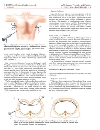 © 2005 WebMD, Inc. All rights reserved.                                                       ACS Surgery: Principles and Practice
 4 THORAX                                                                                     9 CHEST WALL PROCEDURES — 4

                                                                            Outcome Evaluation
                                                                             In general, the results of pectus excavatum repair are good, and
                                                                          the overall complication rate is low. In one study, 90% of 76 pa-
                                                                          tients operated on over a 30-year period experienced excellent
                                                                          outcomes, and only one patient required reoperation for a recur-
                                                                          rent defect.14 The incidence of complications (pleural effusions,
                                                                          pneumonia, and wound seromas) was 14%.14 In another study, no
                                                                          operative deaths occurred in more than 800 repairs, and only a few
                                                                          cases of serious infections and bleeding were reported.16 Other
                                                                          investigators have reported rare complications arising from the
                                                                          migration of sternal support bars and wires.17


                                                                          REPAIR OF PECTUS CARINATUM

                                                                             Surgical repair of pectus carinatum resembles surgical repair of
                                                                          pectus excavatum in several respects. The same skin incision is
                                                                          employed, and the pectoralis major muscles are elevated in a sim-
                                                                          ilar manner. Subperichondrial resection of the abnormal cartilages
Figure 5 Repair of pectus excavatum: Nuss procedure. Incisions            is then carried out, usually extending to the second costal carti-
are made on either side of the chest. A Crawford vascular clamp is        lage. Next, a generous V-shaped osteotomy is made in the upper
inserted through the right intercostal space and advanced along           portion of the sternum at the point of maximal protrusion, which
the sternum and out the left intercostal space.
                                                                          is usually near the insertion of the second cartilage. Occasionally,
                                                                          a second osteotomy is required near the caudal end of the sternum
Lorenz pectus introducer is then placed through the right inter-          to facilitate elevation of the manubrium and depression of the ster-
costal space under thoracoscopic visualization and advanced along         num. Finally, the osteotomy is closed with nonabsorbable mono-
the posterior sternum and out the corresponding left intercostal          ﬁlament sutures, drains are placed, and soft tissue is closed as in a
space [see Figure 5].                                                     pectus excavatum repair.
                                                                             The results of pectus carinatum repair are generally compara-
   Step 3: placement and ﬁxation of bar. An umbilical tape is pulled      ble to those of pectus excavatum repair. Most patients experience
through the anterior mediastinum and attached to the bar, which           good outcomes, and operative morbidity is low.
is then gently pulled, with the concave side up, through the inter-
costal space. A Lorenz pectus bar rotator is employed to ﬂip the
bar over, and the ends of the bar are positioned in the subcuta-          Procedures for Acquired Chest Wall Disease
neous space [see Figure 6]. Occasionally, for proper alignment, the
                                                                          TRANSAXILLARY FIRST RIB RESECTION FOR THORACIC OUTLET
bar may have to be removed and rebent, or stabilizers may have to
                                                                          SYNDROME
be placed alongside it. When the bar is correctly positioned, it is
sutured to the chest wall musculature with an absorbable suture
on one end and a permanent suture on the other.                             Preoperative Evaluation
   The bar is usually left in place for 2 years. Excellent results have     TOS results from compression of the subclavian blood vessels
been reported.15 Signiﬁcant complications include bar displace-           or the brachial plexus as these structures exit the bony thorax.
ment necessitating reoperation (9.2% of procedures), pneumo-              Symptoms may be primarily vascular (e.g., arm swelling or loss of
thorax (4.8%), infection (2%), and pleural effusion (2%). Rare            pulse) or neurogenic (e.g., pain and paresthesias).The workup for
complications include cardiac injury, thoracic outlet syndrome            TOS includes a detailed physical examination, as well as imaging
(TOS), pericarditis, and sternal erosion caused by the bar.               and nerve conduction studies.




                a                                                             b




                Figure 6 Repair of pectus excavatum: Nuss procedure. (a) The pectus bar is pulled into the tunnel
                opened by the vascular retractor, then ﬂipped to provide the desired chest contour. (b)The ends of the
                bar are then sutured to the chest wall musculature.
 
