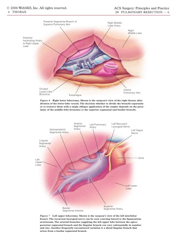 what is surgical resection of the lung what is surgical resection of the lung