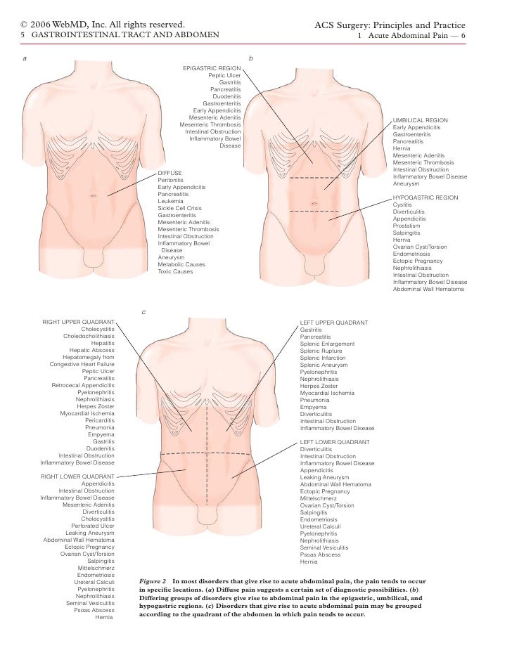 Acs0501 Acute Abdominal Pain 2006 gastritis pain location diagram 
