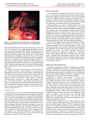 © 2006 WebMD, Inc. All rights reserved.                                                      ACS Surgery: Principles and Practice
5 GASTROINTESTINAL TRACT AND ABDOMEN                                                 18 GASTROINTESTINAL ENDOSCOPY — 10


                                                                         Chromoendoscopy
                                                                            The development of extirpative endoscopy has allowed physi-
                                                                         cians to treat several conditions that previously required open or
                                                                         laparoscopic surgical procedures. However, it is not always possible
                                                                         to see the difference between diseased and healthy tissue on
                                                                         endoscopy, and this limitation has precluded one-stage procedures.
                                                                         Identification of tissue types required biopsy, and lesion margins
                                                                         were impossible to determine at the time of the procedure.
                                                                            Chromoendoscopy can help to identify diseased tissue and
                                                                         define lesion borders.This process is essentially an in vivo staining
                                                                         technique in which a variety of specialized stains are applied to tis-
                                                                         sues to improve their characterization. It differs from carbon-dye
                                                                         injection (tattooing), a technique that is used for later surgical
                                                                         identification, in that the stains used for chromoendoscopy are
                                                                         specific to the anatomic area being examined. Several chromoen-
                                                                         doscopic dyes are commercially available in the United States [see
                                                                         Table 1]. Selection of a particular agent is based on the type of tis-
                                                                         sue being studied, the disease state, and physician familiarity.
Figure 15 Therapeutic colonoscopy. Shown is a right colonic                 One of the first agents used for chromoendoscopy was methyl-
angiodysplasia after treatment with bipolar electrocoagulation.          ene blue. It was initially used in Japan in the 1970s to detect
                                                                         intestinal metaplasia in the stomach. Subsequent studies in the
Diverticular bleeding often stops when colonoscopy is done, and          United States, Japan, and Europe independently demonstrated
only in rare instances is the actual bleeding diverticulum seen. In      that methylene blue will selectively stain metaplasia in Barrett’s
such cases, injection of epinephrine solution around the mouth of        esophagus (see above). On routine screening endoscopy in
the offending diverticulum is often effective. Angiodysplasias are       patients with Barrett’s esophagus, methylene blue chromoen-
frequently found in the right colon, though they are rarely identi-      doscopy offers improved detection of dysplasia and early malig-
fied while they are bleeding [see Figure 14]. They may be treated        nancy compared with four-quadrant random biopsy studies.
with a variety of modalities, including bipolar electrocoagulation,      Other reported applications include esophageal carcinoma, gas-
injection of a sclerosant solution, and laser therapy [see Figure 15].   tric metaplasia, oropharyngeal cancer, mucosal lesions, and het-
Currently, the argon plasma coagulator is often employed for             erotopic gastric mucosa.
obliteration of these lesions.This device has the advantage of being
able to obliterate angiodysplasias with minimal wall penetration,        Endoscopic Mucosal Resection
thereby increasing the safety of this intervention in the thin-walled
right colon.                                                                Endoscopic polypectomy marked the beginning of extirpative
   Strictures may occur in the colon, as in the rest of the GI           procedures. Subsequently, endoscopic resection techniques have
tract. Colonic strictures usually develop at an anastomosis,             continued to advance, as a result of improvements in imaging and
though they may also be the result of ischemia. Hydrostatic bal-         instrumentation, along with the development of chromoendoscopy
loon dilation is very effective in treating such strictures.The bal-     and specific techniques designed as adjuncts to tissue removal. One
loon is introduced through the lumen of the endoscope, and               such technique is endoscopic mucosal resection (EMR).
dilation is carried out under direct vision, often in conjunction           EMR has its basis in the anatomy of the GI tract.
with fluoroscopic observation to confirm that dilation is com-           Histologically, the GI tract has three layers: a superficial muco-
plete. In patients with fully or almost fully obstructing tumors         sal, a middle submucosal, and an outer muscular layer. EMR is
of the colon, self-expanding metal stents may be placed to pro-          designed to help the endoscopist remove superficial mucosal tis-
vide decompression and at least temporary relief of obstruction.         sue while leaving the deeper submucosal and muscular layers
This step may avert emergency surgery or, if the tumor is inop-          intact. These layers can be relatively easily separated from each
erable, provide palliation.                                              other by injecting a liquid that spreads within the plane of injec-
                                                                         tion. This step elevates the layers superficial to the injection, thus
COMPLICATIONS                                                            facilitating the resection of those layers. Advantages over other
   Perforation may occur as a result of transmural thermal injury        resection techniques include the preservation of histologic archi-
during polypectomy. Some perforations are immediately apparent,          tecture (in contrast to electrocautery or laser ablation), which
but others may not be noticed for several days. When perforation         allows improved pathologic assessment; the ease with which
is documented, surgical exploration is indicated. Occasionally, a        EMR can be combined with endoscopic ultrasonography; and its
patient may present with fever and abdominal tenderness several          safety and minimal invasiveness.
days after polypectomy but show no free air on abdominal films.             EMR was first described in 1955, when submucosal saline
Such a patient may have a thermal injury to the bowel wall or so-        injections through a rigid sigmoidoscope were used in the resec-
called postpolypectomy syndrome and can usually be treated with          tion of rectal and sigmoid polyps. In 1973, a submucosal saline
intravenous fluids, antibiotics, and observation. Bleeding from the      injection was employed to assist with the removal of sessile polyps
stalk of a pedunculated polyp may occur after excision; it may pre-      throughout the colon. Additional development was accomplished
sent immediately or may be delayed until the coagulum on the             in Japan in 1983, when mucosal resection was used in the treat-
stalk separates 3 to 5 days after polypectomy. Such bleeding is a        ment of early gastric carcinoma in a technique termed strip-off
rare occurrence.When it does occur, it can be treated by injecting       biopsy.The technique has been refined and is now routinely used
epinephrine solution (1:10,000) into the stalk.                          for lesions in the esophagus, stomach, duodenum, colon, and rec-
 