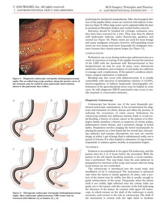 © 2006 WebMD, Inc. All rights reserved.                                                     ACS Surgery: Principles and Practice
 5 GASTROINTESTINAL TRACT AND ABDOMEN                                                18 GASTROINTESTINAL ENDOSCOPY — 7


                                                                       positioning for intraductal manipulations. After electrosurgical divi-
                                                                       sion of the papilla, biliary stones are retrieved with balloon or bas-
                                                                       kets [see Figure 9]. Often, large stones can be captured within the duct
                                                                       in mechanical lithotripsy baskets and crushed before removal.
                                                                          Strictures should be brushed for cytologic evaluation once
                                                                       they have been traversed by a wire. They may then be dilated
                                                                       with hydrostatic balloons under fluoroscopic guidance and
                                                                       stented [see Figure 10]. Plastic stents are used for most benign
                                                                       and many malignant strictures; however, self-expanding metal
                                                                       stents are now being used more frequently for malignant stric-
                                                                       tures because they remain patent longer [see Figure 11].
                                                                       COMPLICATIONS

                                                                          Perforation can occur during endoscopic sphincterotomy as a
                                                                       result of extension or tearing of the papilla beyond the junction
                                                                       of the CBD with the duodenal wall. Retroperitoneal or free
                                                                       intraperitoneal air may be seen. In many cases, intravenous
                                                                       antibiotics, hydration, and avoidance of oral intake are sufficient
                                                                       to manage such complications. If the patient’s condition deteri-
                                                                       orates, surgical exploration is indicated.
Figure 8 Diagnostic endoscopic retrograde cholangiopancreatog-            Bleeding may also occur with sphincterotomy. It is usually
raphy. The so-called long scope position, along the greater curve of   controllable with injection of epinephrine solution (1:10,000),
the stomach, may be useful in some pancreatic interventions;           electrocoagulation, or balloon tamponade. Arteriographic em-
shown is the pancreatic duct orifice.                                  bolization of the gastroduodenal artery may be helpful in some
                                                                       cases. As with diagnostic ERCP, pancreatitis may occur; it usu-
                                                                       ally responds to conservative measures.


a                                     b
                                      b                                Diagnostic Colonoscopy
                                                                          Colonoscopy has become one of the most frequently per-
                                                                       formed endoscopic examinations. It has revolutionized the diag-
                                                                       nosis and treatment of colonic disease and offers the promise of
                                                                       reducing the occurrence of colon cancer. Indications for
                                                                       colonoscopy include iron deficiency anemia, frank or occult rec-
                                                                       tal bleeding, a history of colonic cancer in the patient or in first-
                                                                       degree family members, a history or suspicion of colonic polyps,
                                                                       inflammatory bowel disease, and a persistent change in bowel
                                                                       habits. Preparation involves purging the bowel mechanically by
                                                                       placing the patient on a clear liquid diet for several days, then giv-
                                                                       ing cathartics and enemas; alternatively, one may use osmotic
                                                                       lavage, in which 1 gal of lavage fluid is administered orally over a
                                                                       period of 4 hours. It is often helpful to administer 10 mg of meto-
                                                                       clopramide to enhance gastric motility as preparation begins.
                                                                       TECHNIQUE
c
c                                     d
                                      d
                                                                          Sedation is accomplished as for upper GI endoscopy, and the
                                                                       patient fasts for 6 to 8 hours before the procedure. With the
                                                                       patient in the left lateral decubitus position, a rectal examina-
                                                                       tion is performed. This step helps relax the anal sphincter in
                                                                       preparation for insertion of the scope and ensures that low-lying
                                                                       rectal lesions are not overlooked.
                                                                          The colonoscope is introduced into the rectal vault, and
                                                                       insufflation of air is commenced. The instrument is advanced
                                                                       only when the lumen is clearly apparent. At times, only a por-
                                                                       tion of the lumen may be visible, but this is usually enough to
                                                                       guide advancement of the scope. Frequently, when the lumen
                                                                       itself is not visible, light reflected onto the colonic folds can
                                                                       guide one to the lumen, with the concavity of the fold indicating
                                                                       the direction of the lumen. In contrast with upper GI endos-
Figure 9 Therapeutic endoscopic retrograde cholangiopancreatog-        copy, in which torsion on the shaft of the endoscope is rarely
raphy. After endoscopic sphincterotomy, CBD stones may be              necessary, such torsion is the rule in colonoscopy. The shaft of
retrieved with balloons (a) or baskets (b, c, d).                      the instrument is rotated with the right hand to facilitate
 