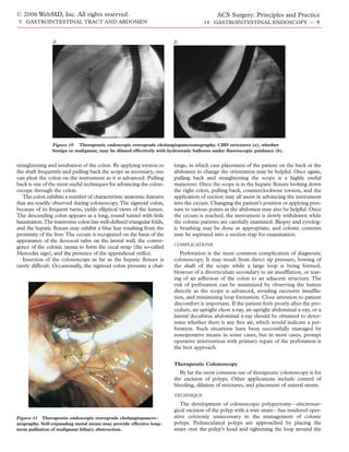 © 2006 WebMD, Inc. All rights reserved.                                                    ACS Surgery: Principles and Practice
5 GASTROINTESTINAL TRACT AND ABDOMEN                                                 18 GASTROINTESTINAL ENDOSCOPY — 8


                a                                                      b




                Figure 10 Therapeutic endoscopic retrograde cholangiopancreatography. CBD strictures (a), whether
                benign or malignant, may be dilated effectively with hydrostatic balloons under fluoroscopic guidance (b).


straightening and intubation of the colon. By applying torsion to      lenge, in which case placement of the patient on the back or the
the shaft frequently and pulling back the scope as necessary, one      abdomen to change the orientation may be helpful. Once again,
can pleat the colon on the instrument as it is advanced. Pulling       pulling back and straightening the scope is a highly useful
back is one of the most useful techniques for advancing the colon-     maneuver. Once the scope is in the hepatic flexure looking down
oscope through the colon.                                              the right colon, pulling back, counterclockwise torsion, and the
   The colon exhibits a number of characteristic anatomic features     application of suction may all assist in advancing the instrument
that are readily observed during colonoscopy. The sigmoid colon,       into the cecum. Changing the patient’s position or applying pres-
because of its frequent turns, yields elliptical views of the lumen.   sure to various points in the abdomen may also be helpful. Once
The descending colon appears as a long, round tunnel with little       the cecum is reached, the instrument is slowly withdrawn while
haustration.The transverse colon has well-defined triangular folds,    the colonic parietes are carefully examined. Biopsy and cytolog-
and the hepatic flexure may exhibit a blue hue resulting from the      ic brushing may be done as appropriate, and colonic contents
proximity of the liver.The cecum is recognized on the basis of the     may be aspirated into a suction trap for examination.
appearance of the ileocecal valve on the lateral wall, the conver-
                                                                       COMPLICATIONS
gence of the colonic taenia to form the cecal strap (the so-called
Mercedes sign), and the presence of the appendiceal orifice.              Perforation is the most common complication of diagnostic
   Insertion of the colonoscope as far as the hepatic flexure is       colonoscopy. It may result from direct tip pressure, bowing of
rarely difficult. Occasionally, the sigmoid colon presents a chal-     the shaft of the scope while a large loop is being formed,
                                                                       blowout of a diverticulum secondary to air insufflation, or tear-
                                                                       ing of an adhesion of the colon to an adjacent structure. The
                                                                       risk of perforation can be minimized by observing the lumen
                                                                       directly as the scope is advanced, avoiding excessive insuffla-
                                                                       tion, and minimizing loop formation. Close attention to patient
                                                                       discomfort is important. If the patient feels poorly after the pro-
                                                                       cedure, an upright chest x-ray, an upright abdominal x-ray, or a
                                                                       lateral decubitus abdominal x-ray should be obtained to deter-
                                                                       mine whether there is any free air, which would indicate a per-
                                                                       foration. Such situations have been successfully managed by
                                                                       nonoperative means in some cases, but in most cases, prompt
                                                                       operative intervention with primary repair of the perforation is
                                                                       the best approach.


                                                                       Therapeutic Colonoscopy
                                                                          By far the most common use of therapeutic colonoscopy is for
                                                                       the excision of polyps. Other applications include control of
                                                                       bleeding, dilation of strictures, and placement of enteral stents.
                                                                       TECHNIQUE

                                                                          The development of colonoscopic polypectomy—electrosur-
                                                                       gical excision of the polyp with a wire snare—has rendered oper-
Figure 11 Therapeutic endoscopic retrograde cholangiopancre-           ative colotomy unnecessary in the management of colonic
atography. Self-expanding metal stents may provide effective long-     polyps. Pedunculated polyps are approached by placing the
term palliation of malignant biliary obstruction.                      snare over the polyp’s head and tightening the loop around the
 
