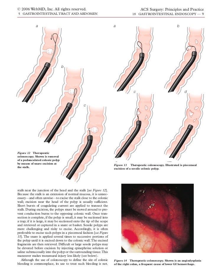 Acs0518 Gastrointestinal Endoscopy 2006
