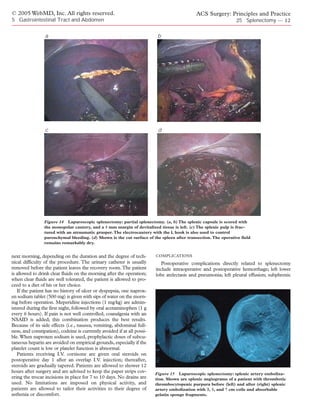 © 2005 WebMD, Inc. All rights reserved.                                                      ACS Surgery: Principles and Practice
5 Gastrointestinal Tract and Abdomen                                                                            25 Splenectomy — 12

                 a                                                        b




                 c                                                        d




                 Figure 14 Laparoscopic splenectomy: partial splenectomy. (a, b) The splenic capsule is scored with
                 the monopolar cautery, and a 5 mm margin of devitalized tissue is left. (c) The splenic pulp is frac-
                 tured with an atraumatic grasper. The electrocautery with the L hook is also used to control
                 parenchymal bleeding. (d) Shown is the cut surface of the spleen after transection. The operative field
                 remains remarkably dry.


next morning, depending on the duration and the degree of tech-          COMPLICATIONS
nical difficulty of the procedure. The urinary catheter is usually          Postoperative complications directly related to splenectomy
removed before the patient leaves the recovery room. The patient         include intraoperative and postoperative hemorrhage; left lower
is allowed to drink clear fluids on the morning after the operation;     lobe atelectasis and pneumonia; left pleural effusion; subphrenic
when clear fluids are well tolerated, the patient is allowed to pro-
ceed to a diet of his or her choice.
   If the patient has no history of ulcer or dyspepsia, one naprox-
en sodium tablet (500 mg) is given with sips of water on the morn-
ing before operation. Meperidine injections (1 mg/kg) are admin-
istered during the first night, followed by oral acetaminophen (1 g
every 6 hours). If pain is not well controlled, coanalgesia with an
NSAID is added; this combination produces the best results.
Because of its side effects (i.e., nausea, vomiting, abdominal full-
ness, and constipation), codeine is currently avoided if at all possi-
ble. When naproxen sodium is used, prophylactic doses of subcu-
taneous heparin are avoided on empirical grounds, especially if the
platelet count is low or platelet function is abnormal.
   Patients receiving I.V. cortisone are given oral steroids on
postoperative day 1 after an overlap I.V. injection; thereafter,
steroids are gradually tapered. Patients are allowed to shower 12
hours after surgery and are advised to keep the paper strips cov-        Figure 15 Laparoscopic splenectomy: splenic artery emboliza-
ering the trocar incisions in place for 7 to 10 days. No drains are      tion. Shown are splenic angiograms of a patient with thrombotic
used. No limitations are imposed on physical activity, and               thrombocytopenic purpura before (left) and after (right) splenic
patients are allowed to tailor their activities to their degree of       artery embolization with 3, 5, and 7 cm coils and absorbable
asthenia or discomfort.                                                  gelatin sponge fragments.
 