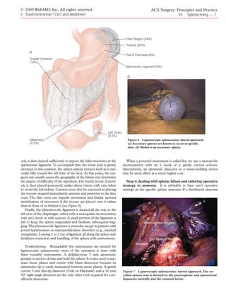 © 2005 WebMD, Inc. All rights reserved.                                                           ACS Surgery: Principles and Practice
5 Gastrointestinal Tract and Abdomen                                                                                 25    Splenectomy — 7




                                                                                Hilar Region (54%)

                                                                                Pedicle (25%)

      a
                                                                                Tail of Pancreas (6%)
      Greater Omentum
      (12%)
                                                                                Splenocolic Ligament (2%)


                                                                                 b




                                                                 Left Ovary
                                                                 (0.5%)
      Mesentery                                                                  Figure 6 Laparoscopic splenectomy: lateral approach.
      (0.5%)                                                                     (a) Accessory spleens are known to occur at specific
                                                                                 sites. (b) Shown is an accessory spleen.



sels, is then incised sufficiently to expose the hilar structures in the         When a powered instrument is called for, we use a monopolar
splenorenal ligament. To accomplish this, the lower pole is gently            electrocautery with an L hook or a gently curved scissors.
elevated; in this position, the spleen almost retracts itself as it nat-      Alternatively, an ultrasonic dissector or a tissue-welding device
urally falls toward the left lobe of the liver. At this point, the sur-       may be used, albeit at a much higher cost.
geon can usually assess the geography of the hilum and determine
the degree of difficulty of the operation.The fourth trocar, if need-            Step 4: dealing with splenic hilum and tailoring operative
ed, is then placed posteriorly under direct vision, with care taken           strategy to anatomy It is advisable to base one’s operative
to avoid the left kidney. Caution must also be exercised in placing           strategy on the specific splenic anatomy. If a distributed anatomy
the trocars situated immediately anterior and posterior to the iliac
crest. The iliac crest can impede movement and hinder upward
mobilization of structures if the trocars are placed over it rather
than in front of or behind it [see Figure 8].
   Finally, the phrenicocolic ligament is incised all the way to the
left crus of the diaphragm, either with a monopolar electrocautery
with an L hook or with scissors. A small portion of the ligament is
left to keep the spleen suspended and facilitate subsequent bag-
ging.The phrenicocolic ligament is avascular except in patients with
portal hypertension or myeloproliferative disorders (e.g., myeloid
metaplasia). Leaving 1 to 2 cm of ligament all along the spleen side
facilitates retraction and handling of the spleen with instruments.

   Troubleshooting. Remarkably few instruments are needed for
laparoscopic splenectomy: most of the operation is done with
three reusable instruments. A dolphin-nose 5 mm atraumatic
grasper is used to elevate and hold the spleen. It is also used to sep-
arate tissue planes and vessels with blunt dissection because its
atraumatic tip is easily insinuated between tissue planes. A gently
curved 5 mm fine-tip dissector (Crile or Maryland) and a 10 mm                Figure 7 Laparoscopic splenectomy: lateral approach. The so-
90º right-angle dissector are the only other tools required for cost-         called splenic tent is formed by the gastrosplenic and splenorenal
efficient dissection.                                                         ligaments laterally and the stomach below.
 