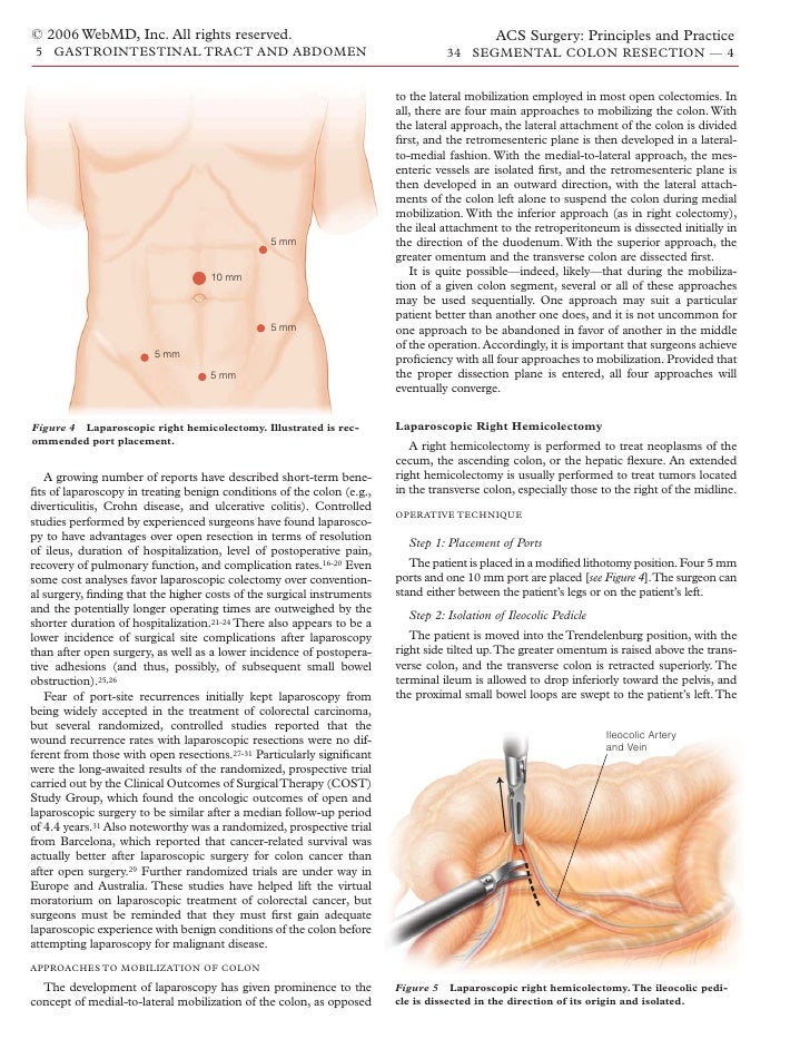 Acs0534 Segmental Colon Resection 2006