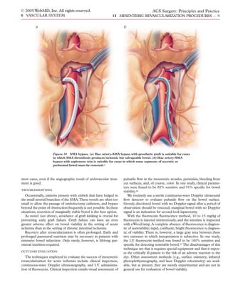 Acs0614 Mesenteric Revascularization Procedures | PDF
