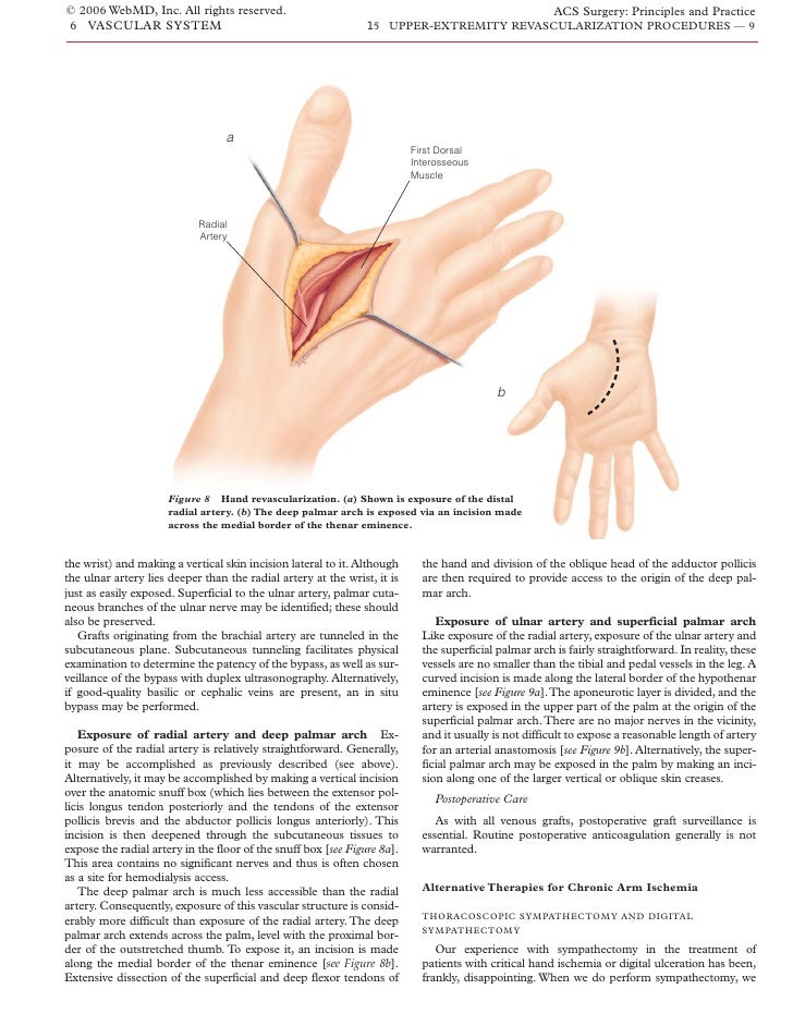 Cpt Code For Vein Patch Angioplasty Of Brachial Artery xilushd