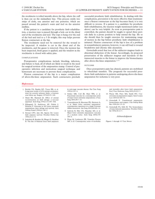 © 2008 BC Decker Inc                                                                  ACS Surgery: Principles and Practice
6 VASCULAR SYSTEM                                                20 LOWER-EXTREMITY AMPUTATION FOR ISCHEMIA — 11

the stockinette is rolled laterally above the hip, where the cuff           successful prosthetic limb rehabilitation. In dealing with this
is then cut on the midaxillary line. This process yields two                complication, prevention is far more effective than treatment:
strips of cloth, one anterior and one posterior, which are                  once a ﬂexion contracture at the hip becomes ﬁxed, it is very
passed around the patient’s waist and tied on the anterior                  difﬁcult to reverse. If a patient is a candidate for prosthetic
midline.                                                                    limb rehabilitation, the traction weight mentioned earlier (see
   If the patient is a candidate for prosthetic limb rehabilita-            above) can be very helpful. As soon as postoperative pain is
tion, a traction rope is passed through a hole cut in the distal            controlled, the patient should be taught to spend three peri-
end of the stockinette and tied. The rope is hung over the end              ods daily in a prone position to help extend the hip. He or
of the bed and tied to a 5 lb weight; this step helps prevent               she should then be taught exercises for maintaining range
ﬂexion contracture at the hip.                                              of motion in the hip before prosthetic limb rehabilitation is
   The stockinette need not be removed for the wound to                     initiated. Flexion contracture of the hip is less of a problem
be inspected. A window is cut in the distal end of the                      in nonambulatory patients; however, it can still lead to wound
stockinette, and the gauze is removed. Once the incision has                breakdown and chronic skin ulceration.
been inspected, fresh gauze is applied, and the window in the                  Gottschalk noted that loss of the adductor magnus leads to
stockinette is closed with safety pins.                                     abnormal abduction of the femur. Accordingly, he proposed
                                                                            preservation of the adductor magnus and myodesis of the
                                                               transected muscles to the femur to improve the biomechanics
  Postoperative complications include bleeding, infection,                  after above-the-knee amputation.11,12
and failure to heal, all of which are likely to result in the need
                                                                            
for surgical revision of the amputation stump. Control of pre-
operative infection and meticulous surgical technique and                     Once postoperative pain has abated, patients are mobilized
hemostasis are necessary to prevent these complications.                    to wheelchair transfers. The prognosis for successful pros-
  Flexion contracture of the hip is a major complication                    thetic limb ambulation in patients undergoing above-the-knee
of above-the-knee amputation. Such contractures preclude                    amputation for ischemia is very poor.


References

1. Reichle FA, Rankin KP, Tyson RR, et al.            in end-stage vascular disease. Eur Vasc Surg       and mortality after lower limb amputation.
   Long-term results of 474 arterial reconstruc-      1992;6:321–6.                                      Eur J Vasc Endovasc Surg 2005;29:633–7.
   tions for severely ischemic limbs: a fourteen   6. Nehler MR, Coll JR, Hiatt WR, et al.           10. Pinzur MS, Pinto MA, Smith DG. Con-
   year follow-up. Surgery 1979;85:93–100.            Functional outcome in a contemporary series        troversies in amputation surgery. Instr Course
2. Maini BS, Mannick JA. Effect of arterial           of major lower extremity amputations. J Vasc       Lect 2003;52:445–51.
   reconstruction on limb salvage: a ten-year         Surg 2003;38:7–14.                             11. Gottschalk F. Transfemoral amputation:
   appraisal. Arch Surg 1978;113:1297–304.         7. Toursarkissian B, Shireman PK, Harrison A,         biomechanics and surgery. Clin Orthop Relat
3. Ellitsgaard N, Andersson AP, Fabrin J,             et al. Major lower extremity amputation:           Res 1999;361:15–22.
   Holstein P. Outcome in 282 lower extremity         contemporary experience in a single Veterans   12. Gottschalk FA, Stills M. The biomechanics
   amputations: knee salvage and survival. Acta       Affairs institution. Am Surg 2002;68:606–10.       of trans-femoral amputation. Prosthet Orthot
   Orthop Scand 1990;61:140–2.                     8. Aulivola B, Hile CN, Hamdan AD, et al.             Int 1994;18:12–7.
4. Stewart CPU, Jain AS, Ogston SA. Lower             Major lower extremity amputation: outcome
   limb amputee survival. Prosthet Orthot Int         of a modern series. Arch Surg 2004;139:
   1992;16:11–8.                                      395–9.                                                       Acknowledgment
5. Inderbitzi R, Buttiker M, Pﬂuger D, Nachbur     9. Ploeg AJ, Lardenoye JW, Vrancken Peeters
   B. The fate of bilateral lower limb amputees       MP, et al. Contemporary series of morbidity    Figures 1 through 10 Tom Moore.




                                                                                                                                                05/08
 