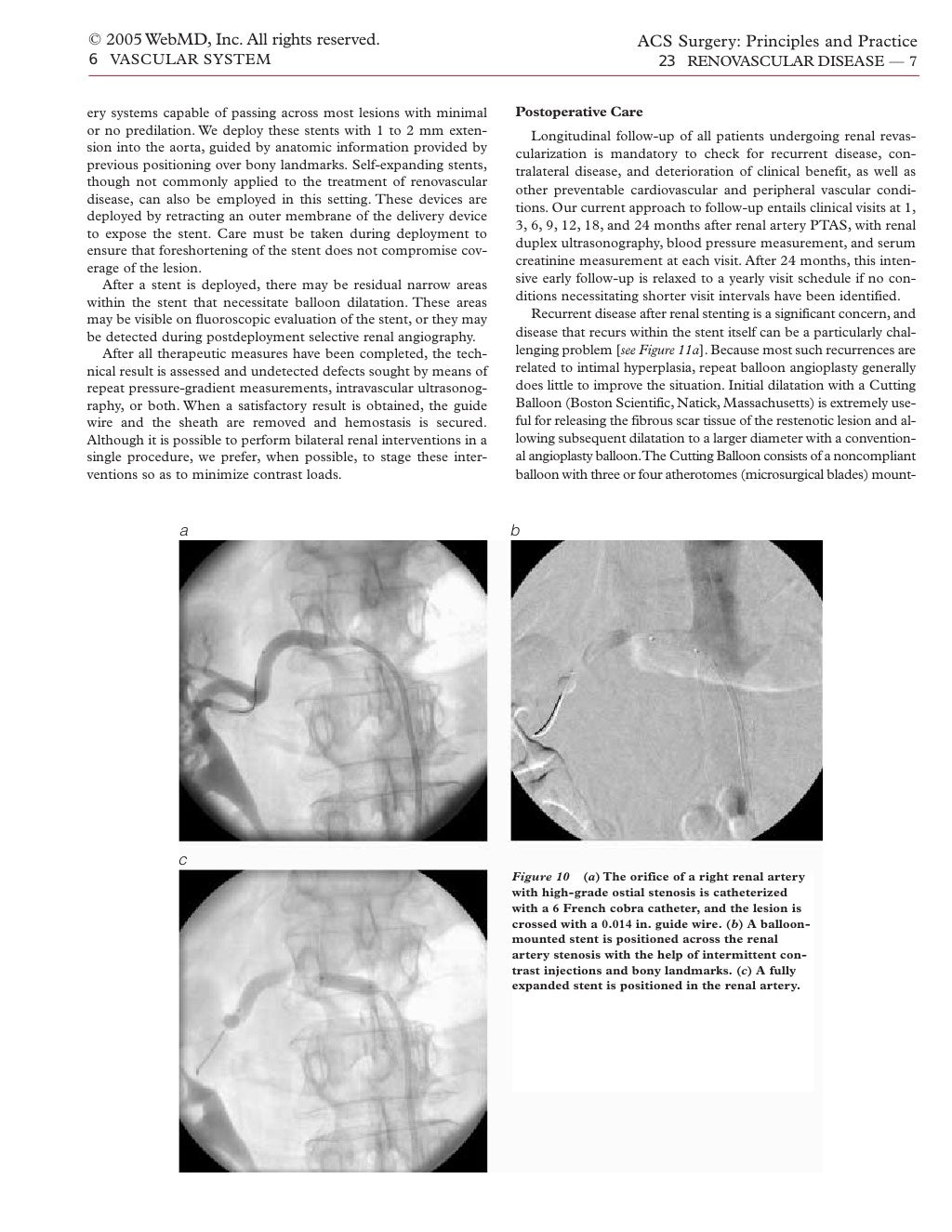 Acs0623 Endovascular Procedures For Renovascular Disease