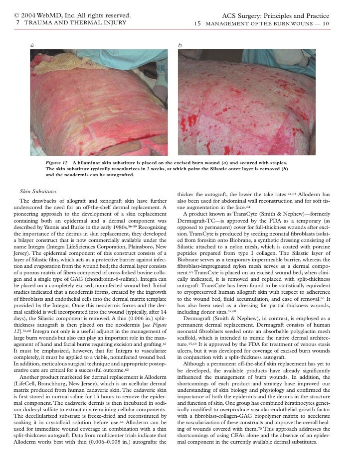 Acs0715 Management Of The Burn Wound