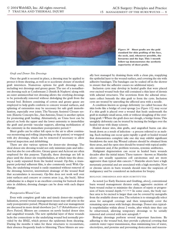 Acs0715 Management Of The Burn Wound