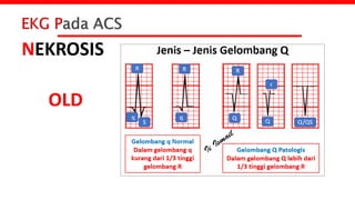 ACS Code Blue [Autosaved].pptx