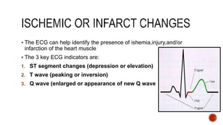  The ECG can help identify the presence of ishemia,injury,and/or
infarction of the heart muscle
 The 3 key ECG indicators are:
1. ST segment changes (depression or elevation)
2. T wave (peaking or inversion)
3. Q wave (enlarged or appearance of new Q wave
 