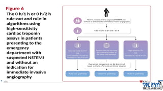 High Sensitivity Trop Ed Algorithm Rule In Algorithm Acute coronary syndrome new latest ppt.pptx