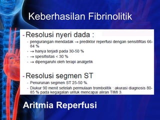 Keberhasilan Fibrinolitik
Aritmia Reperfusi
 